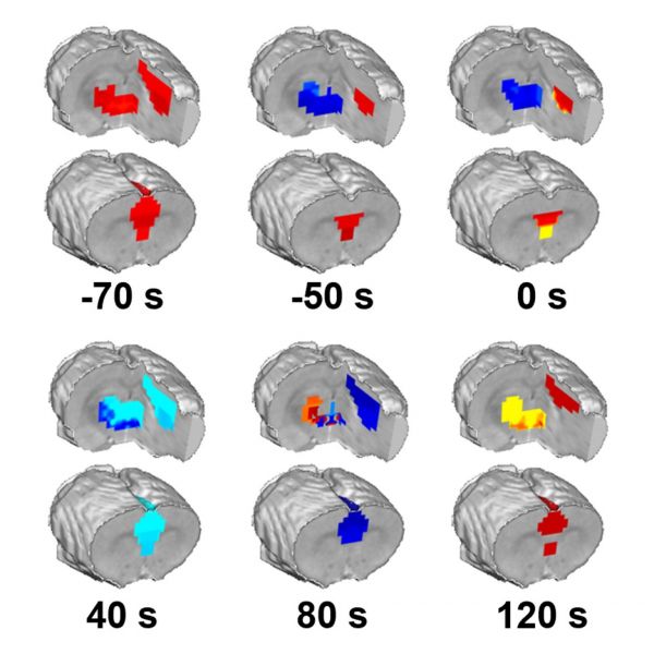 Through studies on rats, a team of researchers at Penn State has pinpointed the exact moment of loss of consciousness due to anesthesia, mapping what happens in different brain regions during that moment.   Credit: Provided by Nanyin Zhang . All Rights Reserved.