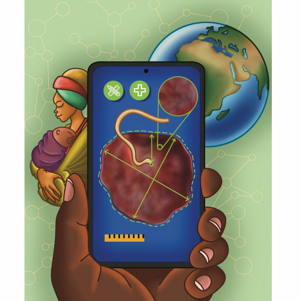 This image depicts a conceptual mobile application designed to empower health care providers to capture and analyze placenta images at birth for immediate diagnostic insights. Credit: Sonhita Chakraborty / Penn State. Creative Commons