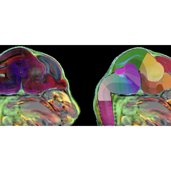 Researchers developed a 3D atlas of the developing mouse brain, with such images as this. Credit: Provided by the Kim Lab / Penn State. Creative Commons