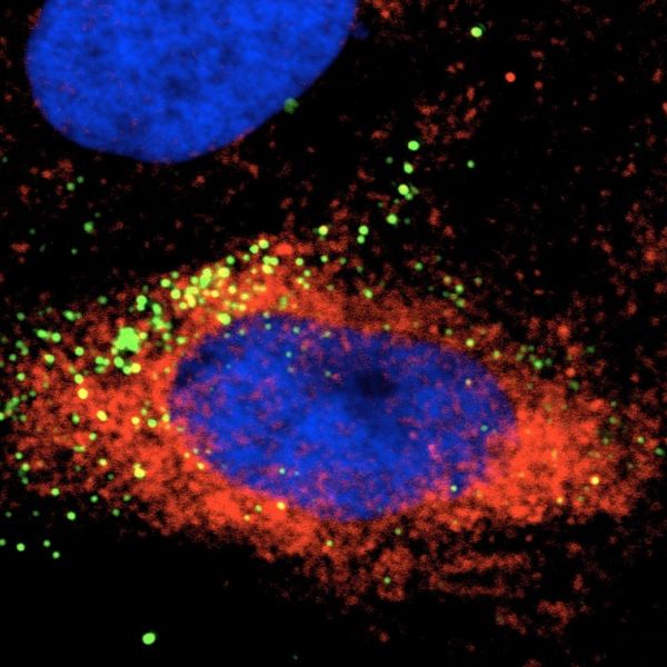 This image shows a cell infected with Zika virus (green). The red is heat shock protein 70 (Hsp70), which appears to play a role in enabling Zika infection of host cells. IMAGE: RASGON LABORATORY / PENN STATE